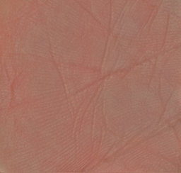 RELAST: Hautaufnahme (homogenisiert)